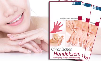 Chronisches Handekzem – Vorbeugung, Pflege und Behandlung